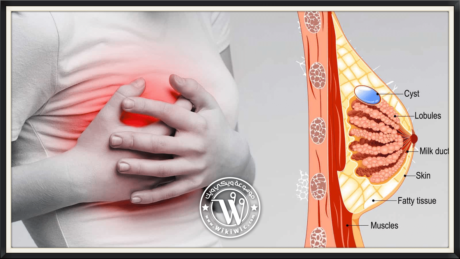 كيف يكون ألم الثدي في بداية الحمل لماذا يحدث ألم الثدي بداية الحمل Wiki Wic ويكي ويك